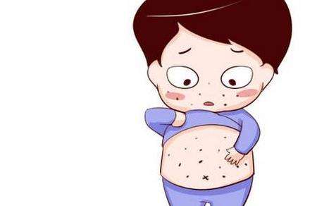 接触性荨麻疹表现症状是什么？